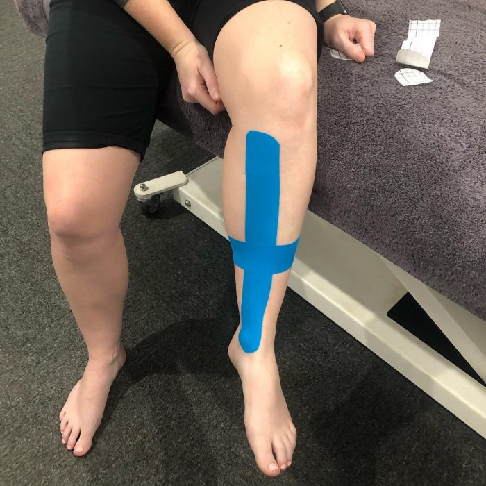 Physio Phebe Taping for Shin Splints